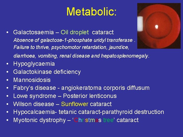 Metabolic: • Galactosaemia – Oil droplet cataract Absence of galactose-1 -phosphate uridyl transferase. Failure