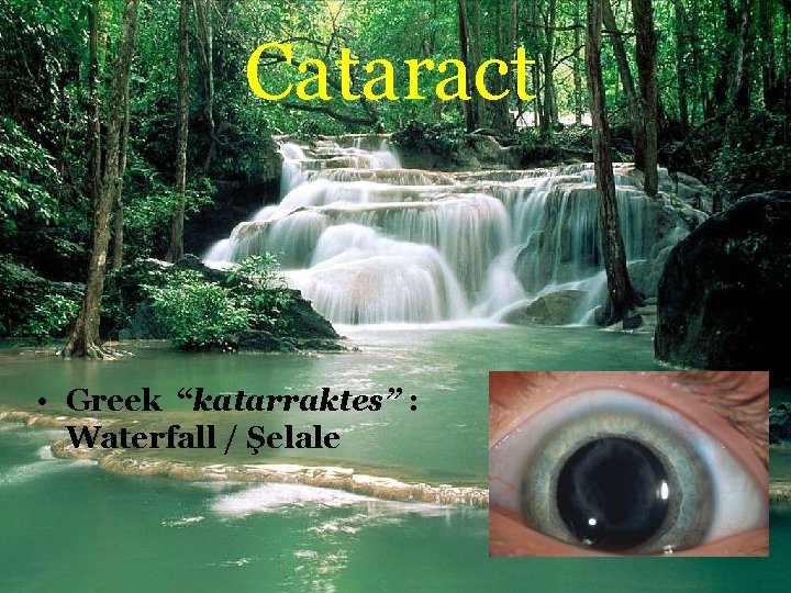 Cataract • Greek “katarraktes” : Waterfall / Şelale 