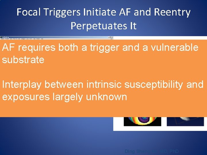 Focal Triggers Initiate AF and Reentry Perpetuates It AF requires both a trigger and