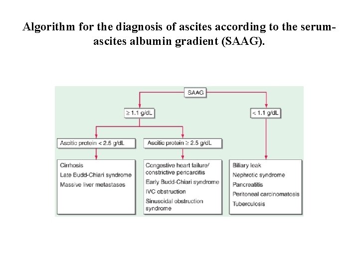 Algorithm for the diagnosis of ascites according to the serumascites albumin gradient (SAAG). 