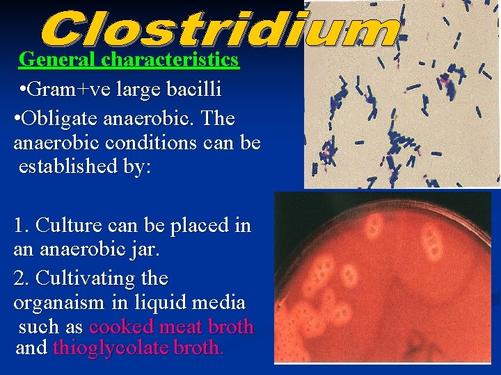 General characteristics • Gram+ve large bacilli • Obligate anaerobic. The anaerobic conditions can be