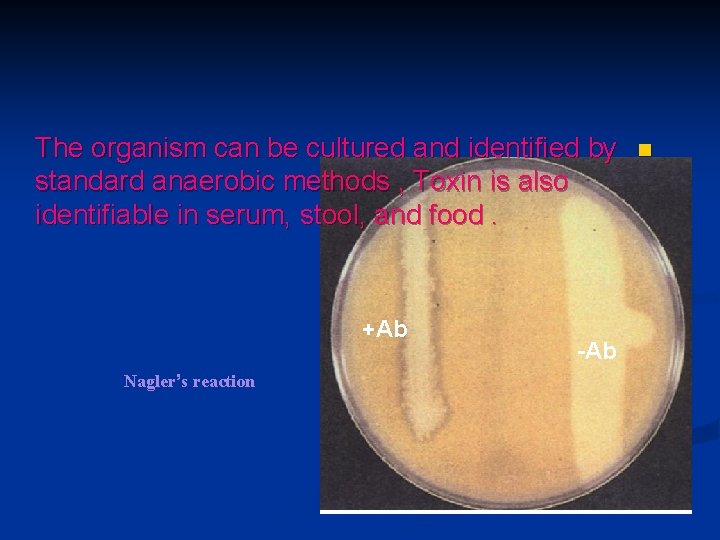 The organism can be cultured and identified by standard anaerobic methods , Toxin is