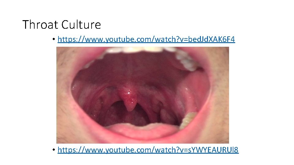 Throat Culture • https: //www. youtube. com/watch? v=bed. Jd. XAK 6 F 4 •