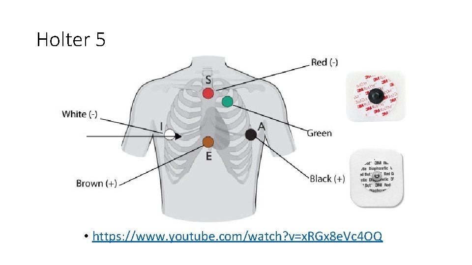 Holter 5 • https: //www. youtube. com/watch? v=x. RGx 8 e. Vc 4 OQ