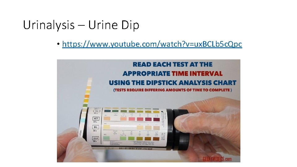 Urinalysis – Urine Dip • https: //www. youtube. com/watch? v=ux. BCLb 5 c. Qpc