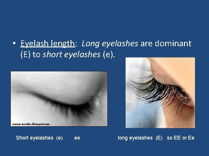  • Eyelash length: Long eyelashes are dominant (E) to short eyelashes (e). Short