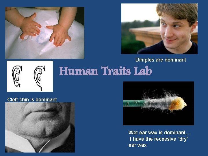 Dimples are dominant Human Traits Lab Cleft chin is dominant Wet ear wax is