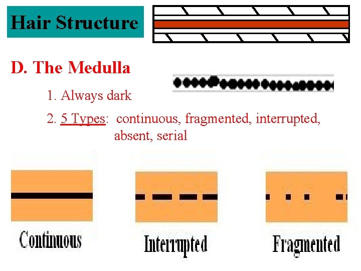 Hair Structure D. The Medulla 1. Always dark 2. 5 Types: continuous, fragmented, interrupted,