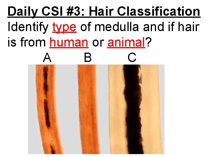 Daily CSI #3: Hair Classification Identify type of medulla and if hair is from