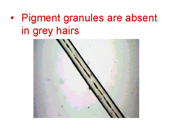  • Pigment granules are absent in grey hairs 
