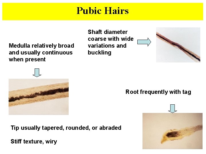 Pubic Hairs Medulla relatively broad and usually continuous when present Shaft diameter coarse with