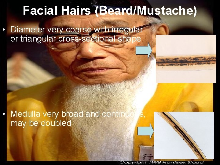 Facial Hairs (Beard/Mustache) • Diameter very coarse with irregular or triangular cross sectional shape Facial Hairs (Beard/Mustache) • Diameter very coarse with irregular or triangular cross sectional shape