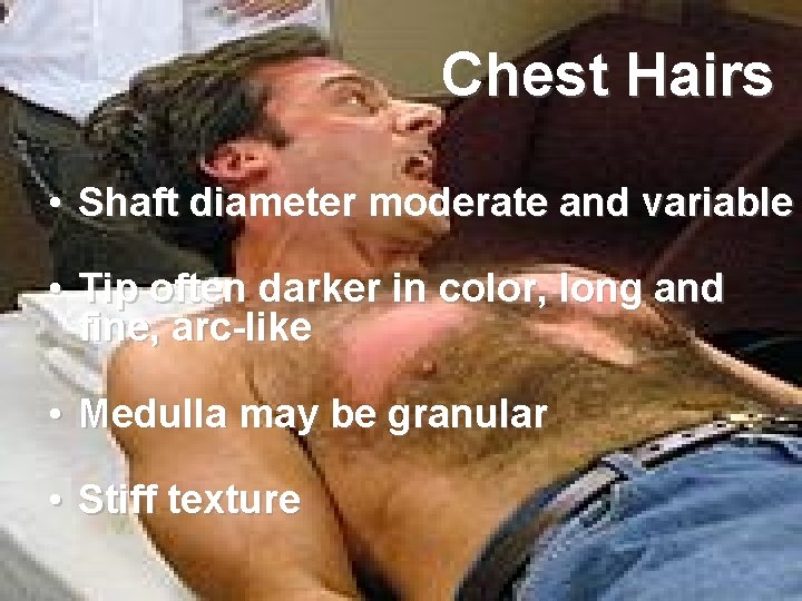 Chest Hairs • Shaft diameter moderate and variable • Tip often darker in color, Chest Hairs • Shaft diameter moderate and variable • Tip often darker in color,