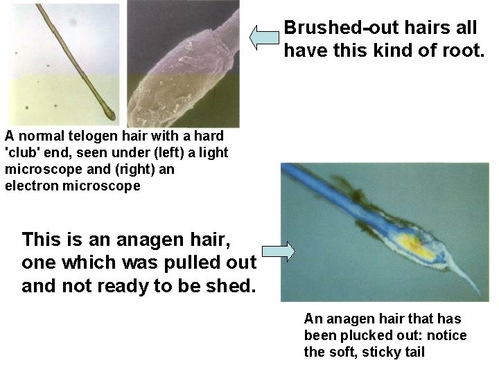 Brushed-out hairs all have this kind of root. A normal telogen hair with a