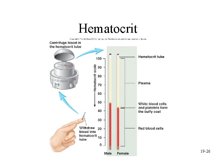 Hematocrit 19 -26 