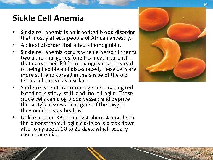 10 Sickle Cell Anemia • Sickle cell anemia is an inherited blood disorder that
