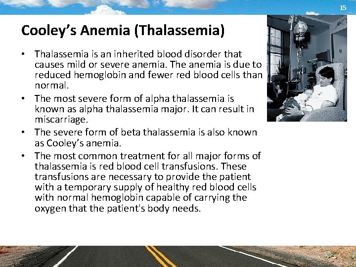 15 Cooley’s Anemia (Thalassemia) • Thalassemia is an inherited blood disorder that causes mild