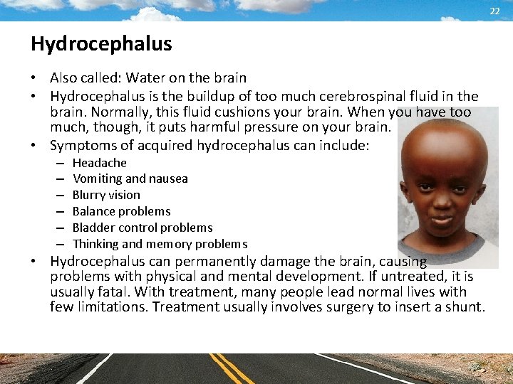 22 Hydrocephalus • Also called: Water on the brain • Hydrocephalus is the buildup