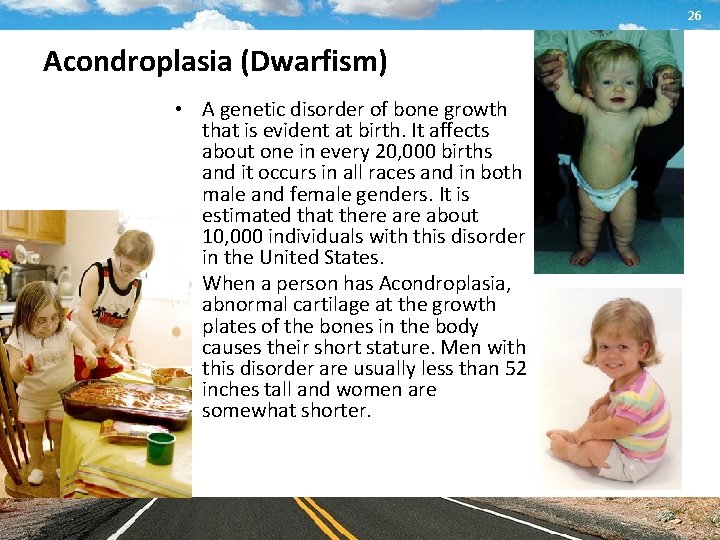 26 Acondroplasia (Dwarfism) • A genetic disorder of bone growth that is evident at