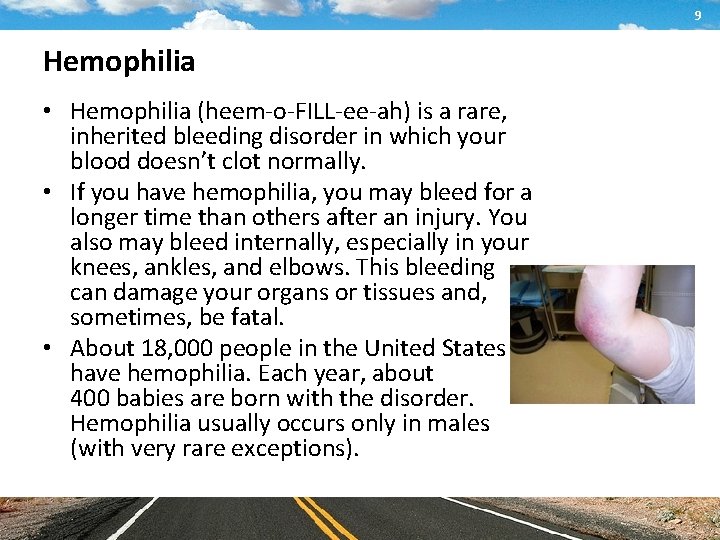 9 Hemophilia • Hemophilia (heem-o-FILL-ee-ah) is a rare, inherited bleeding disorder in which your