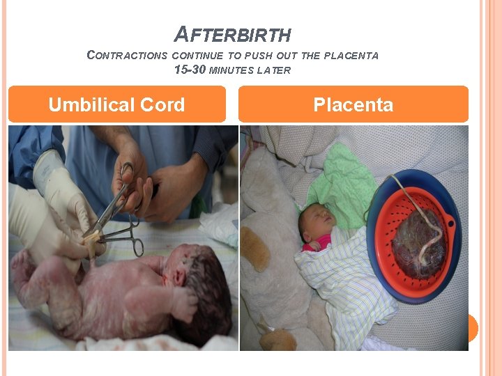 AFTERBIRTH CONTRACTIONS CONTINUE TO PUSH OUT THE PLACENTA 15 -30 MINUTES LATER Umbilical Cord