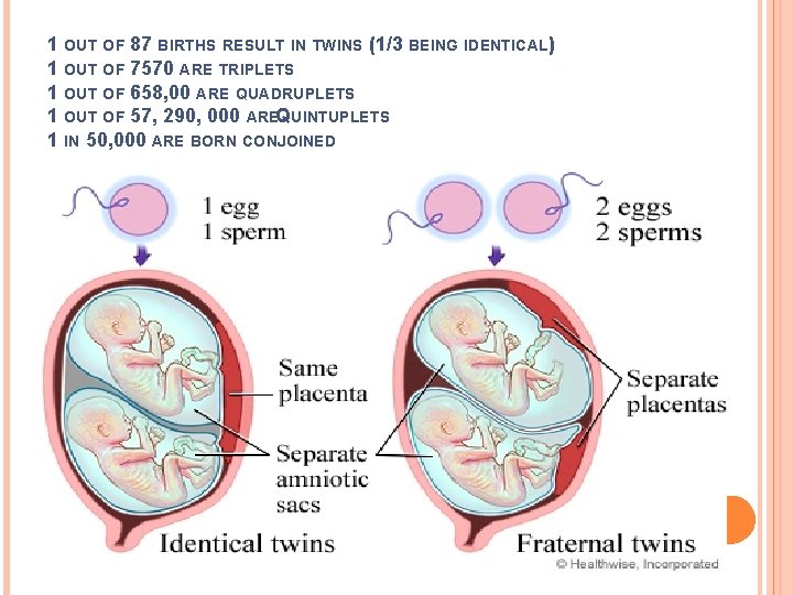 1 OUT OF 87 BIRTHS RESULT IN TWINS (1/3 BEING IDENTICAL) 1 OUT OF