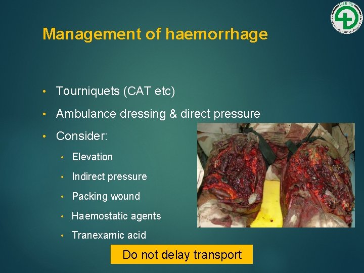 Management of haemorrhage • Tourniquets (CAT etc) • Ambulance dressing & direct pressure •
