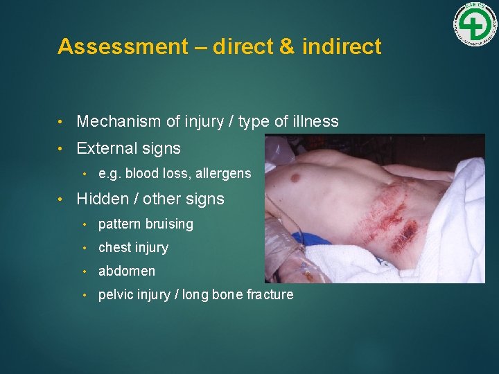 Assessment – direct & indirect • Mechanism of injury / type of illness •