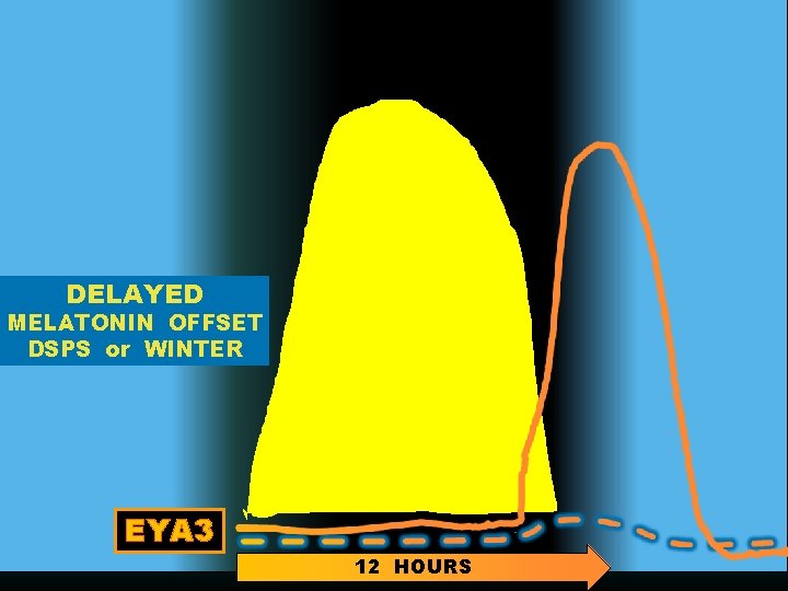 DELAYED MELATONIN OFFSET DSPS or WINTER EYA 3 12 HOURS 