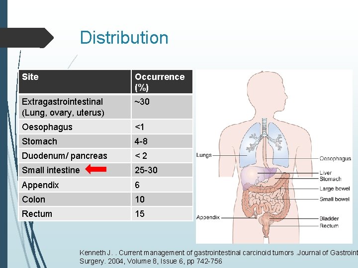 Distribution Site Occurrence (%) Extragastrointestinal (Lung, ovary, uterus) ~30 Oesophagus <1 Stomach 4 -8