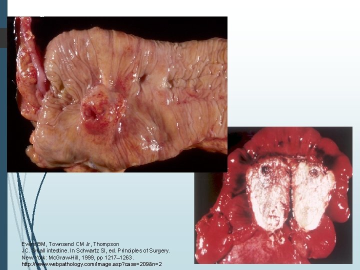 Evers BM, Townsend CM Jr, Thompson JC. Small intestine. In Schwartz SI, ed. Principles