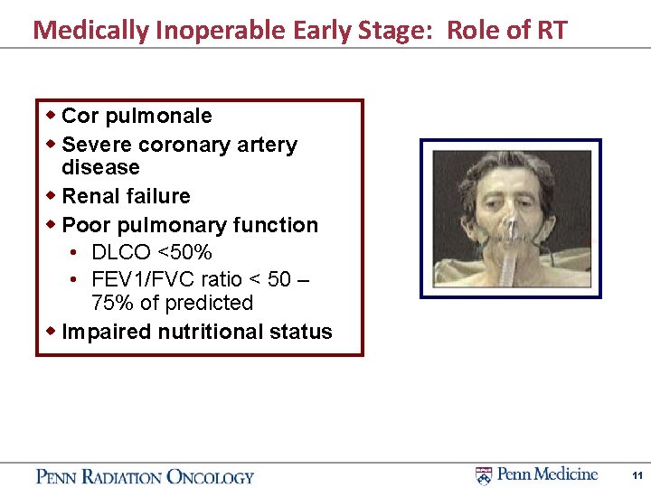 Medically Inoperable Early Stage: Role of RT w Cor pulmonale w Severe coronary artery