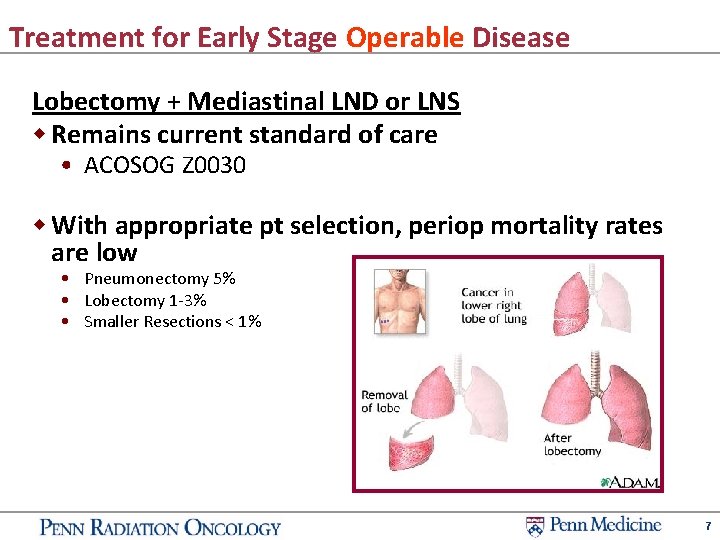 Treatment for Early Stage Operable Disease Lobectomy + Mediastinal LND or LNS w Remains