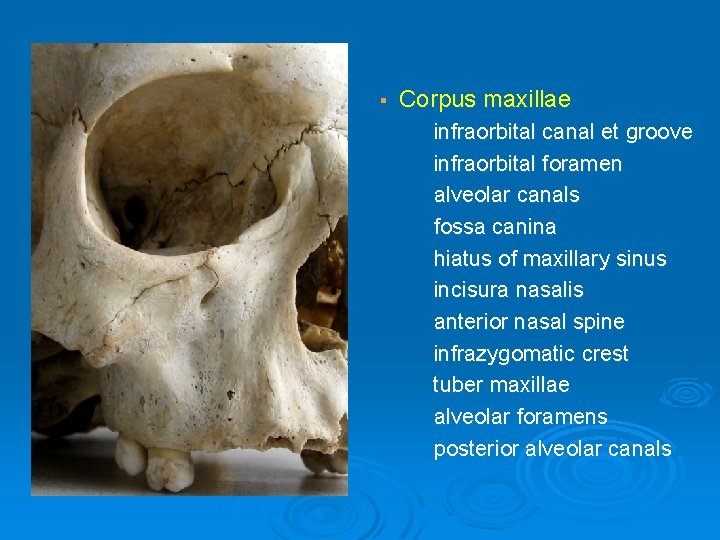 § Corpus maxillae infraorbital canal et groove infraorbital foramen alveolar canals fossa canina hiatus