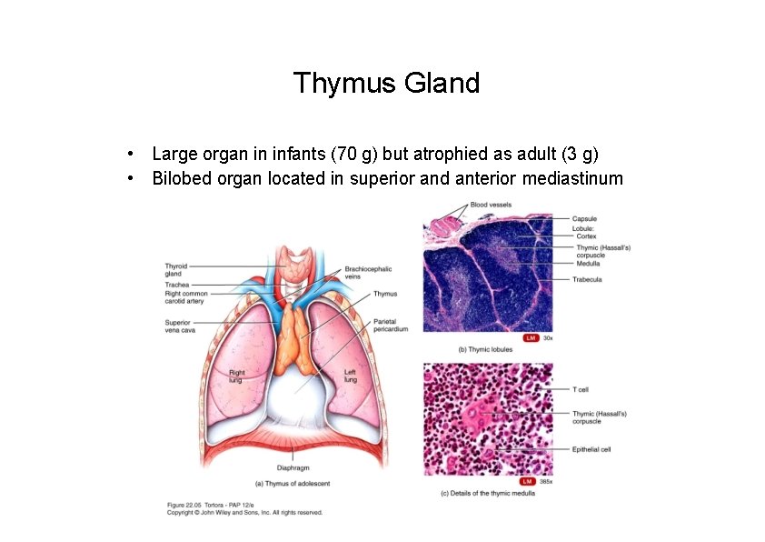Thymus Gland • Large organ in infants (70 g) but atrophied as adult (3