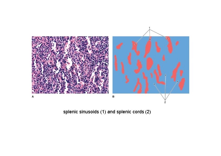 splenic sinusoids (1) and splenic cords (2) 