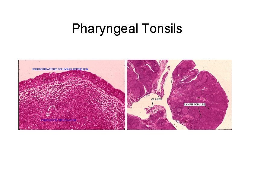 Pharyngeal Tonsils 