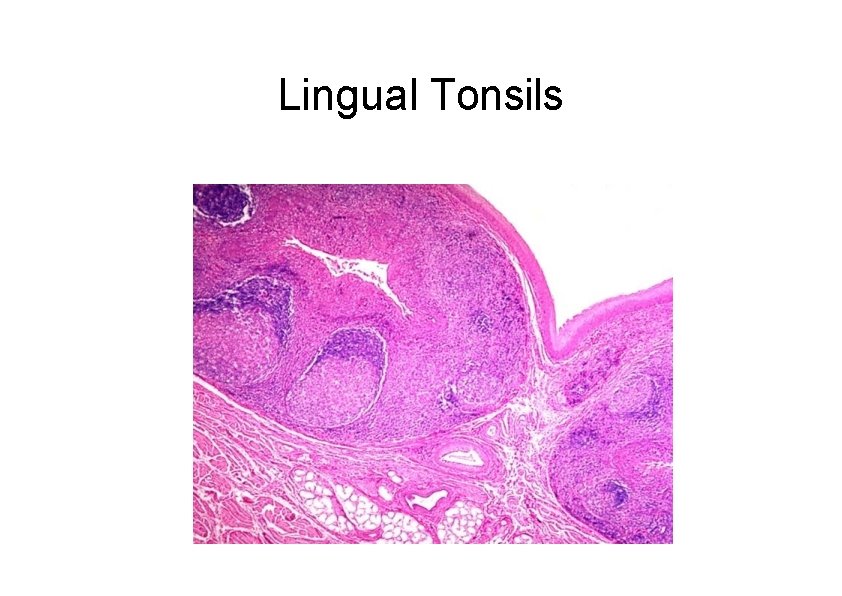 Lingual Tonsils 
