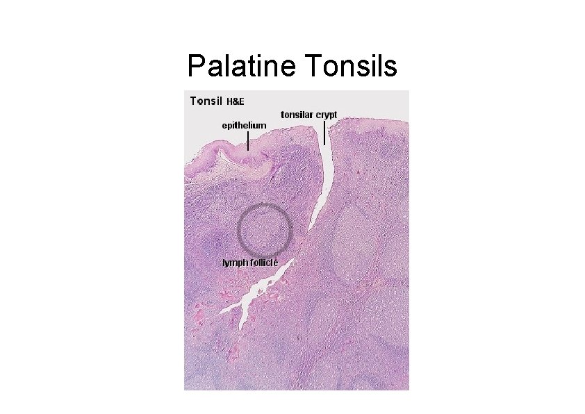 Palatine Tonsils 