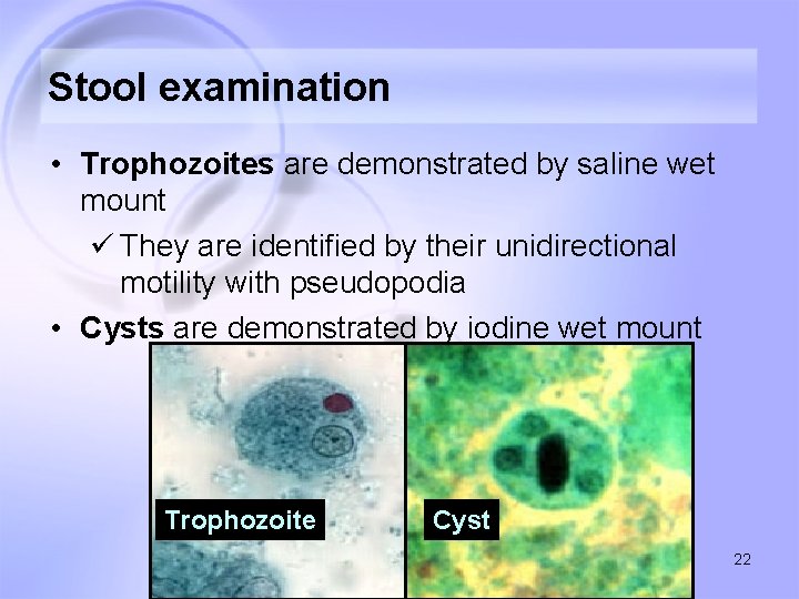 Stool examination • Trophozoites are demonstrated by saline wet mount ü They are identified