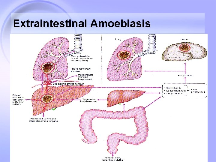 Extraintestinal Amoebiasis 7 