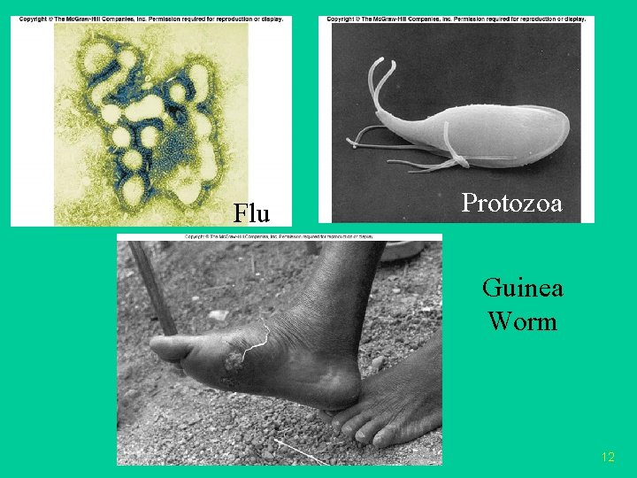 Flu Protozoa Guinea Worm 12 