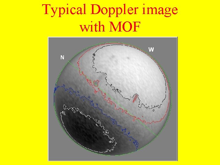 Typical Doppler image with MOF 