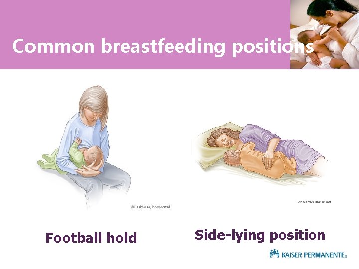 Common breastfeeding positions Football hold Side-lying position 