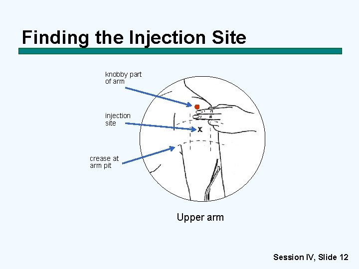 Finding the Injection Site knobby part of arm injection site crease at arm pit