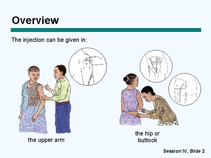 Overview The injection can be given in: X the upper arm the hip or