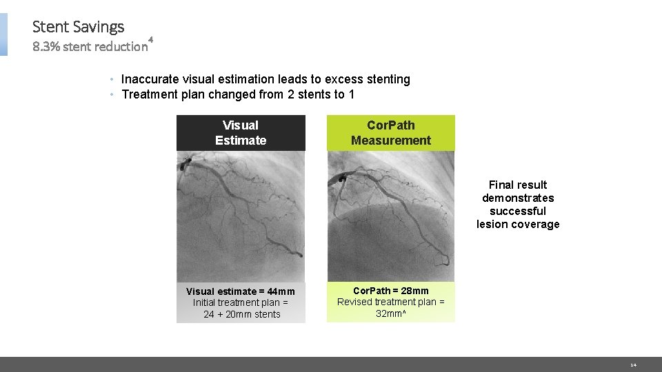 Stent Savings 8. 3% stent reduction 4 • Inaccurate visual estimation leads to excess