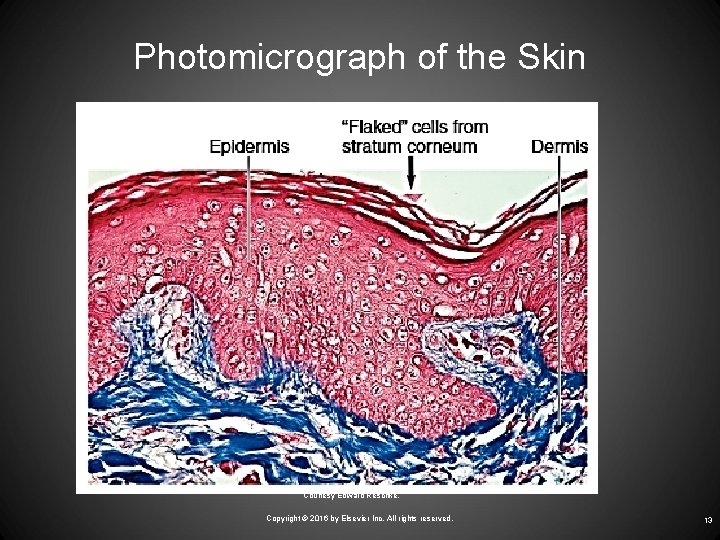 Photomicrograph of the Skin Courtesy Edward Reschke. Copyright © 2016 by Elsevier Inc. All