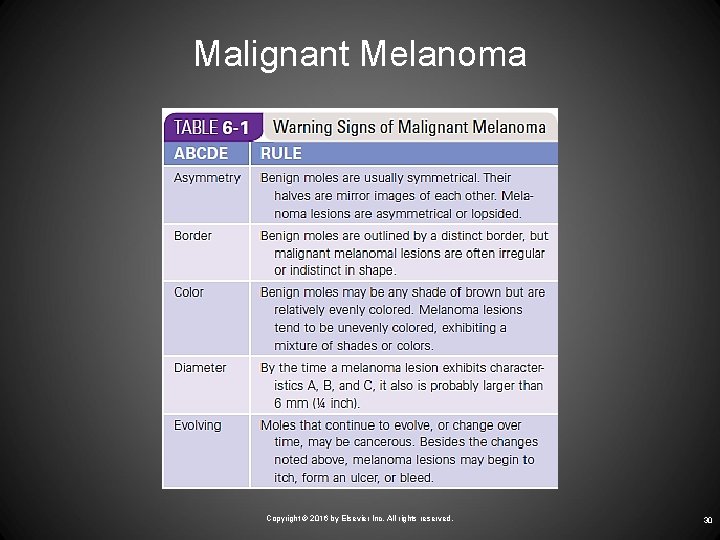Malignant Melanoma Copyright © 2016 by Elsevier Inc. All rights reserved. 30 