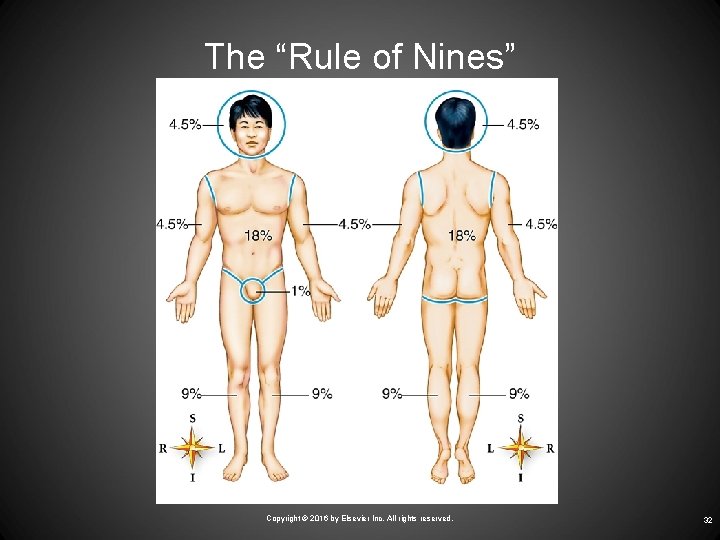 The “Rule of Nines” Courtesy Barbara Cousins. Copyright © 2016 by Elsevier Inc. All